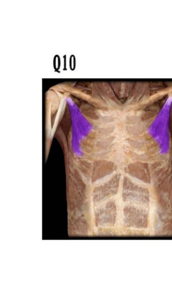 Anterior chest wall dissection with pectoralis minor shaded