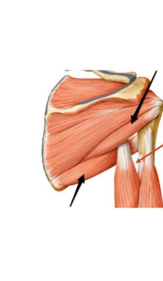 Posterior arm illustration with the triangular interval (A) labelled
