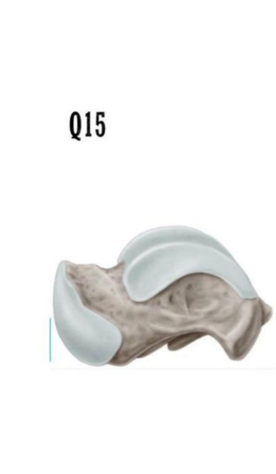Illustration of the right talus