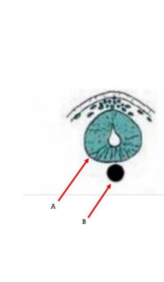 Cross-section of an embryo with neural tube (A) and notochord (B) labelled