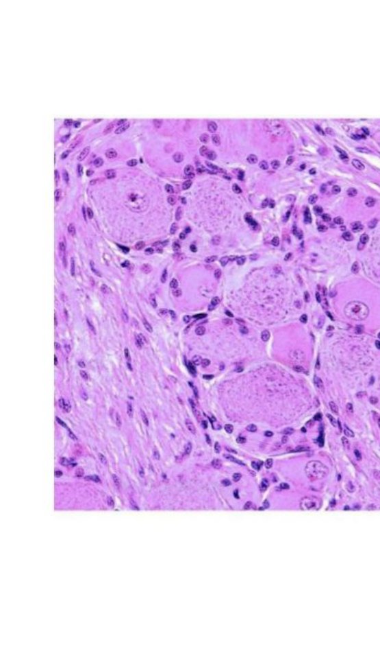 Photomicrograph of a peripheral (dorsal root) ganglion