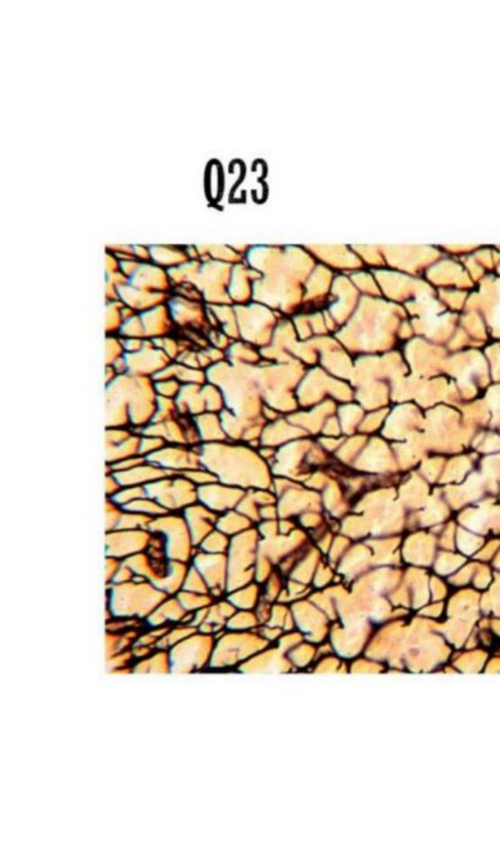 Silver-stained photomicrograph showing a fine reticular fibre network