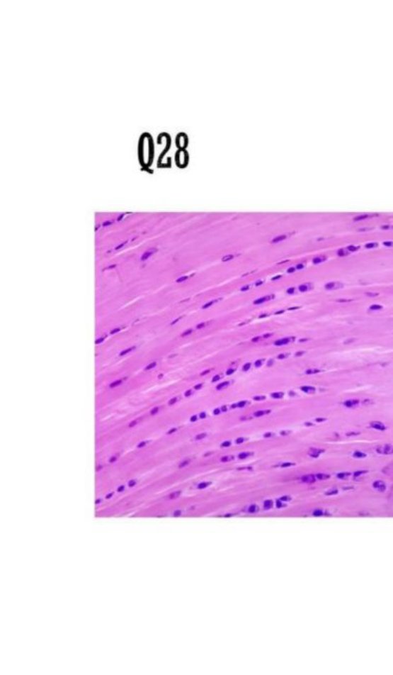 Photomicrograph of fibrocartilage with scattered chondrocytes in dense fibrous tissue