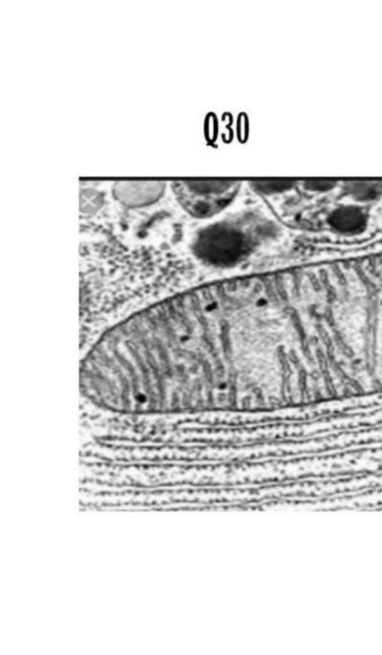 Electron micrograph of a mitochondrion