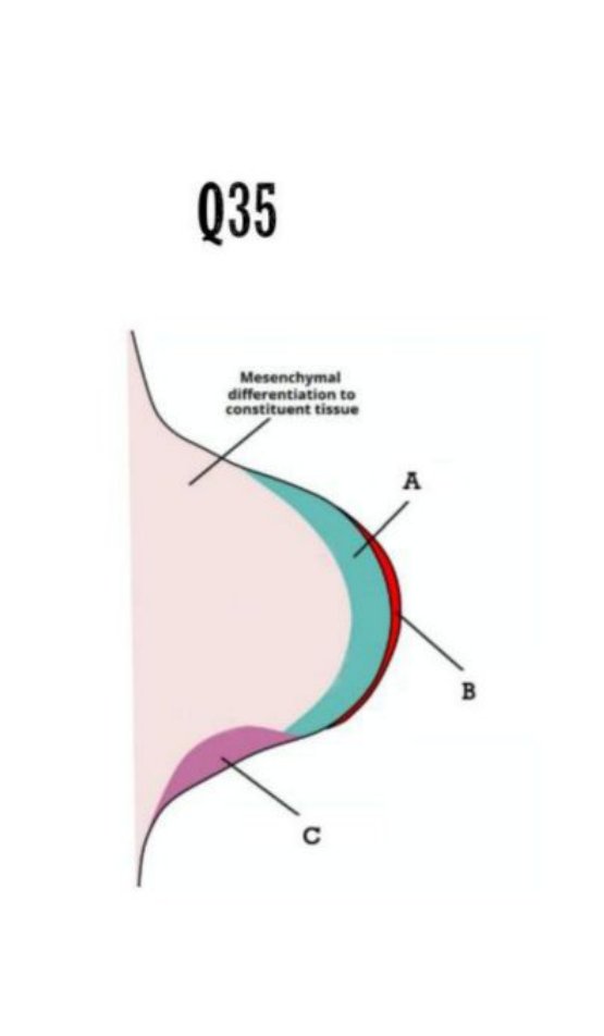 Diagram of a developing limb bud with zone of proliferation (A), apical ectodermal ridge (B), and zone of polarising activity (C) labelled