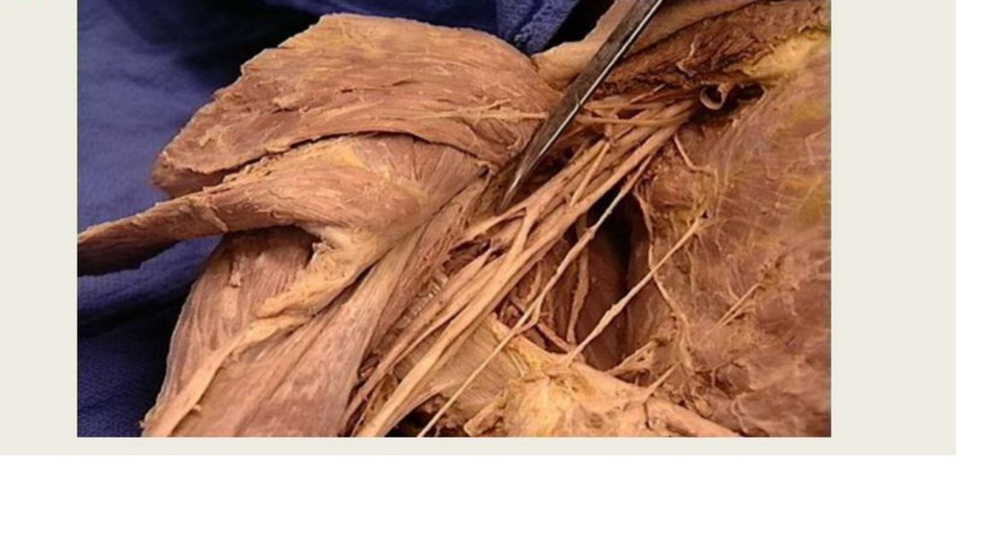 Q2 - axillary dissection, nerve tagged