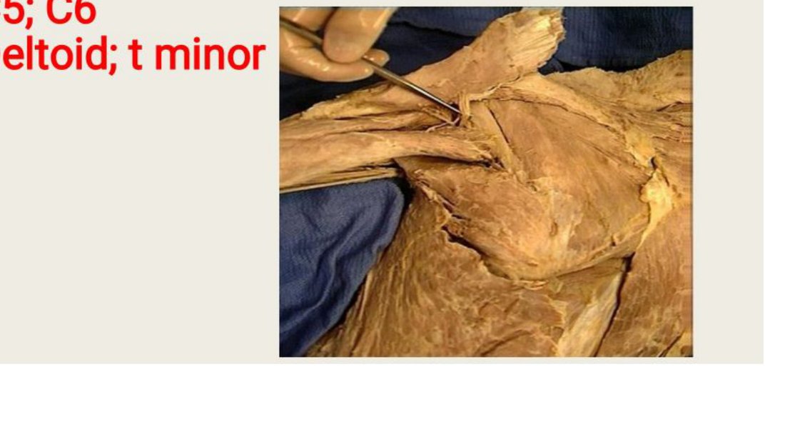 Q4 - probe tagging a nerve at the shoulder