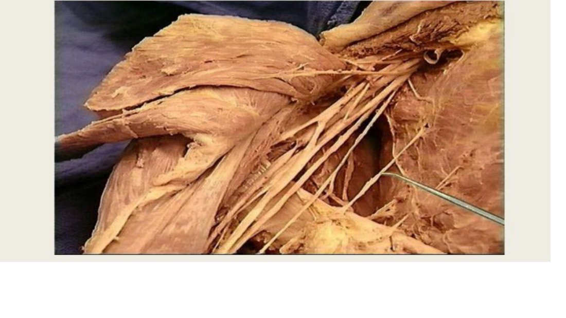Q5 - probe tagging a nerve in the axilla