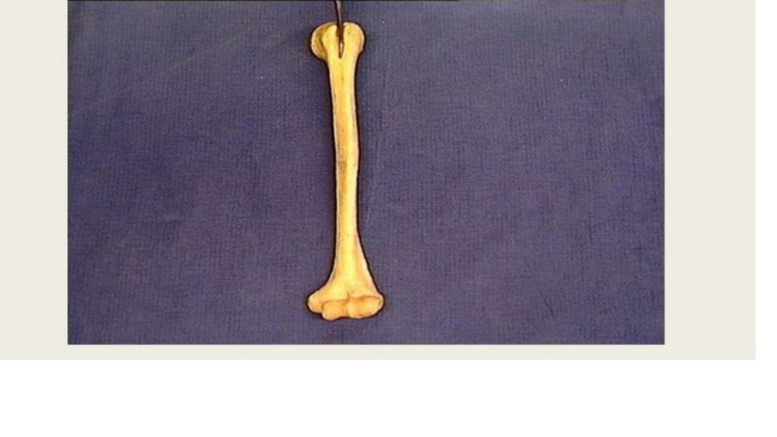 Q6 - humerus with an attachment site pinned