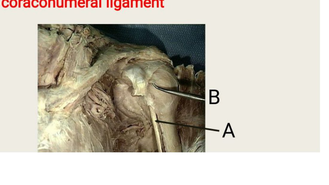 Q11 - shoulder dissection with A and B labelled