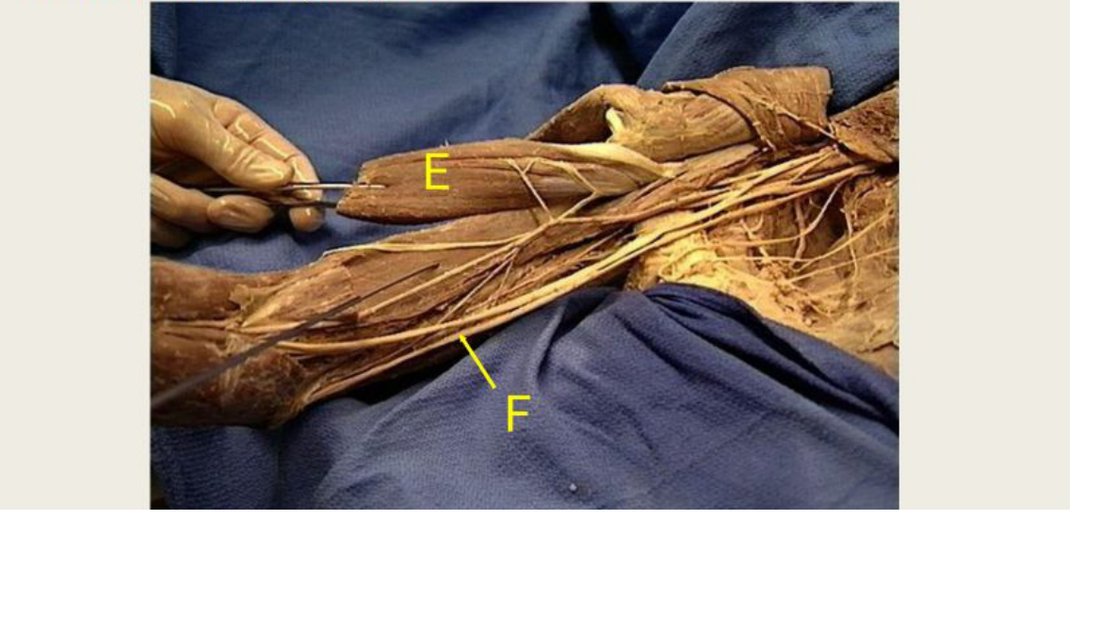Q12 - arm dissection, E and F labelled