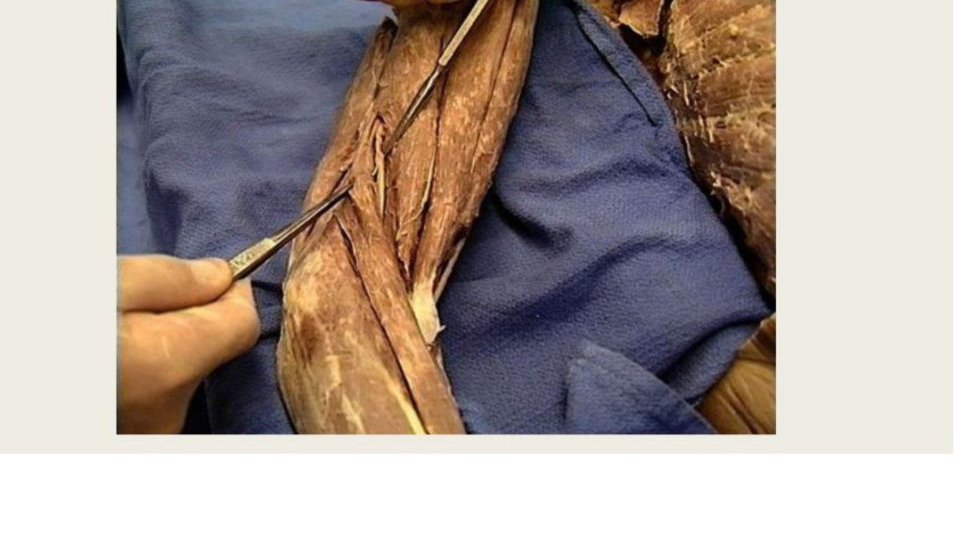 Q13 - probe tagging a nerve at the arm, labelled A