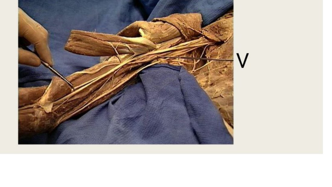 Q14 - artery labelled V in a forearm dissection