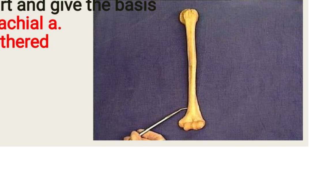 Q15 - humerus with a fracture site pinned