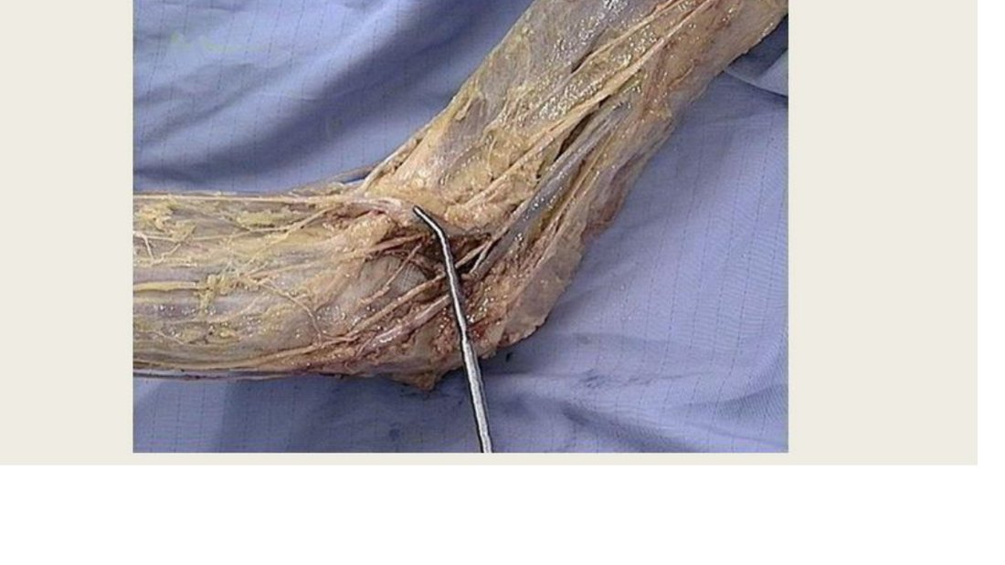 Q17 - pin at the cubital fossa