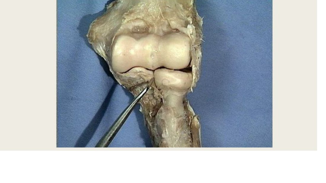 Q18 - probe at the elbow joint