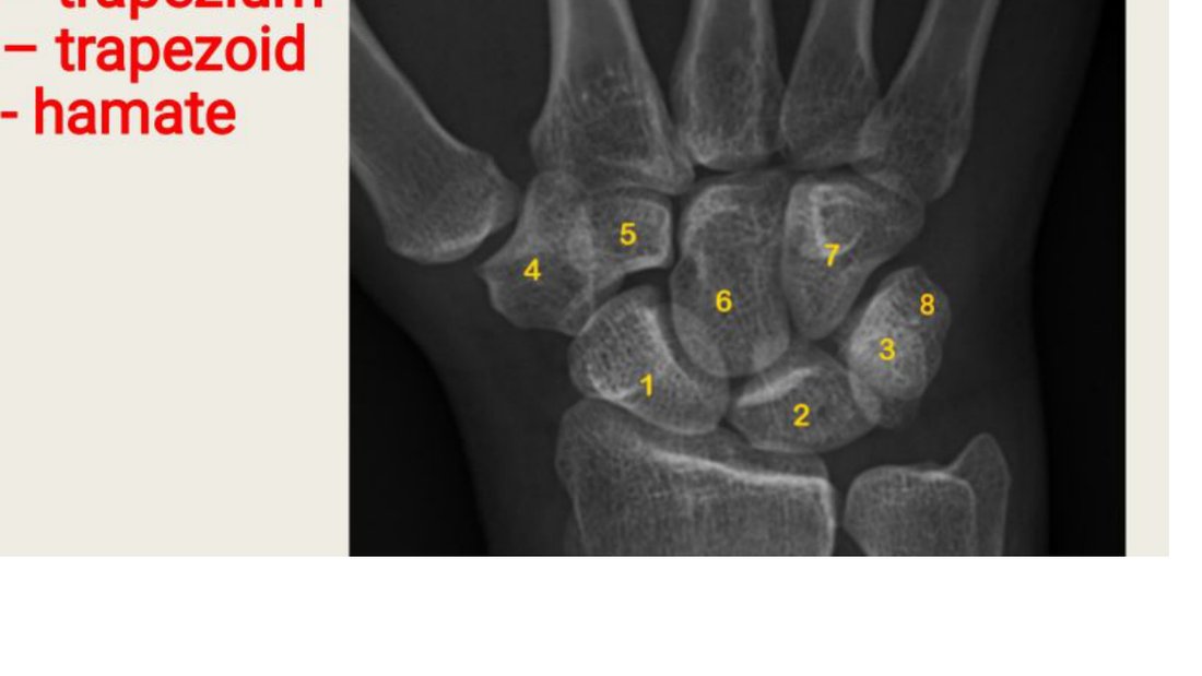 Q19 - wrist X-ray with carpal bones numbered