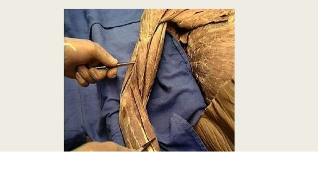 Q22 - probe on a forearm muscle