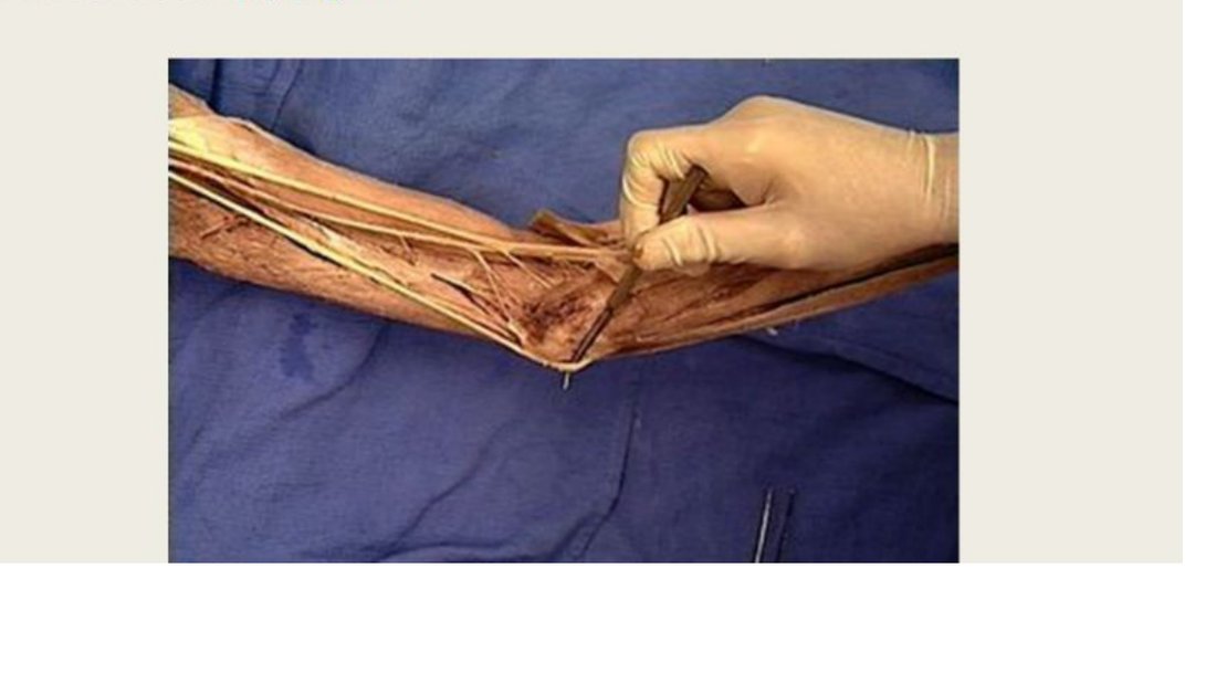 Q30 - nerve at the wrist crease