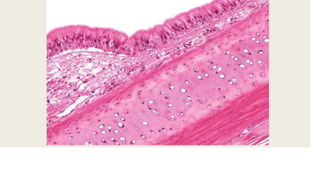 Q32 - ciliated epithelium over connective tissue