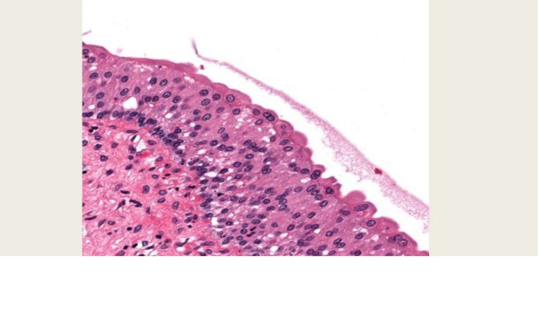 Q38 - transitional epithelium histology
