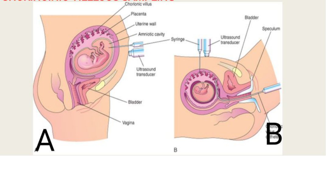 Q46 - diagrams of two prenatal sampling procedures