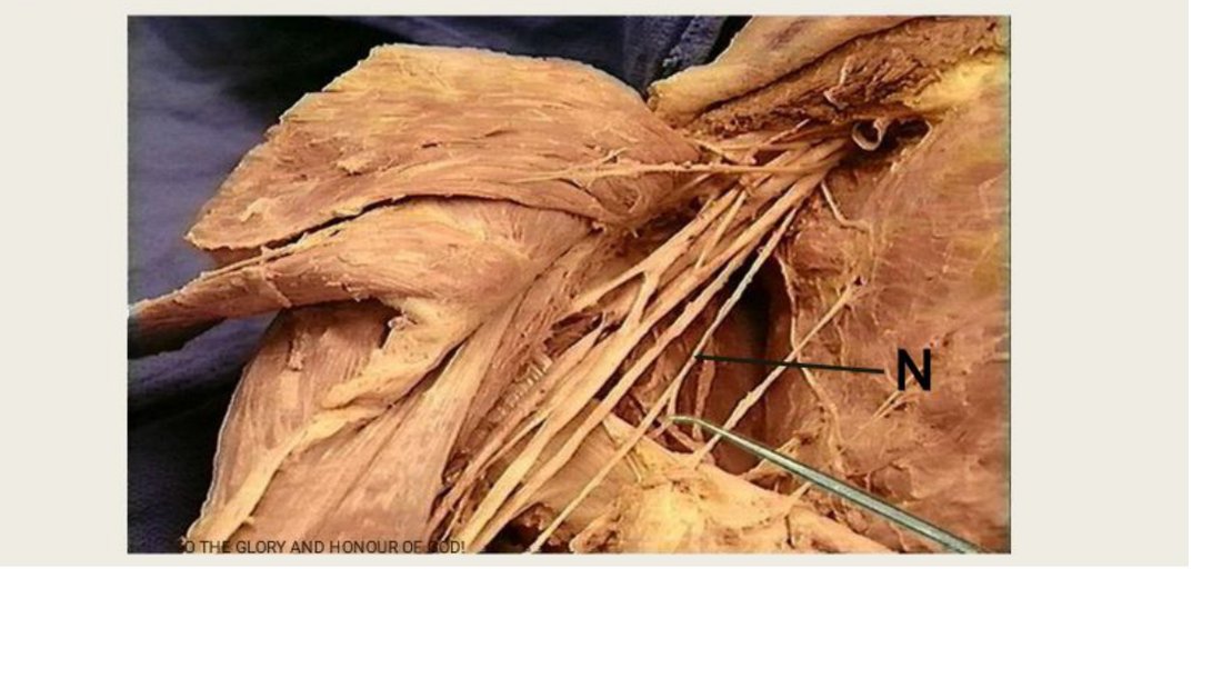 Q1 - dissection of the axilla with a nerve tagged N