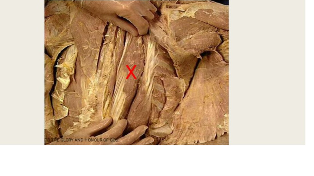 Q7 - digitated muscle on the lateral chest wall marked X