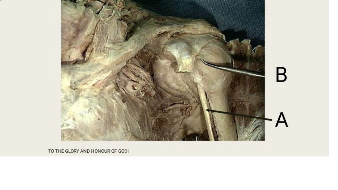 Q11 - labelled dissection, structures A and B