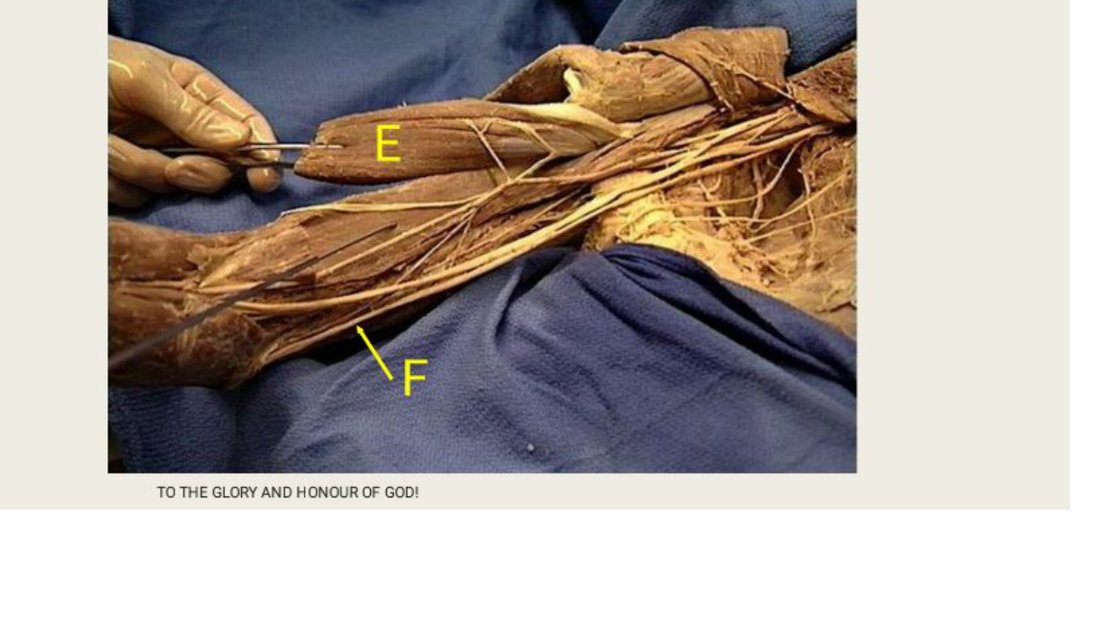 Q12 - forearm dissection, E and F labelled