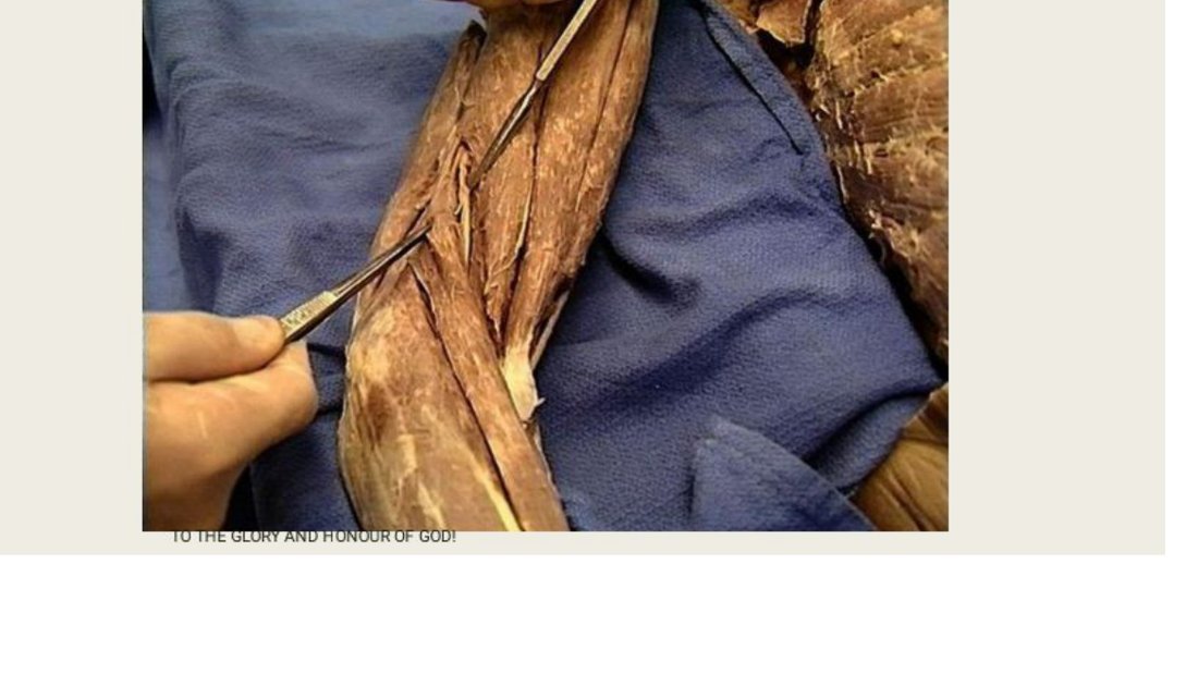 Q13 - probe tagging a nerve at the medial elbow, labelled A