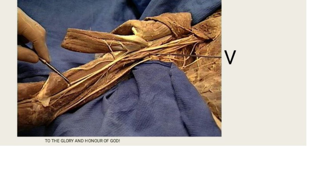 Q14 - artery labelled V in a forearm/cubital fossa dissection