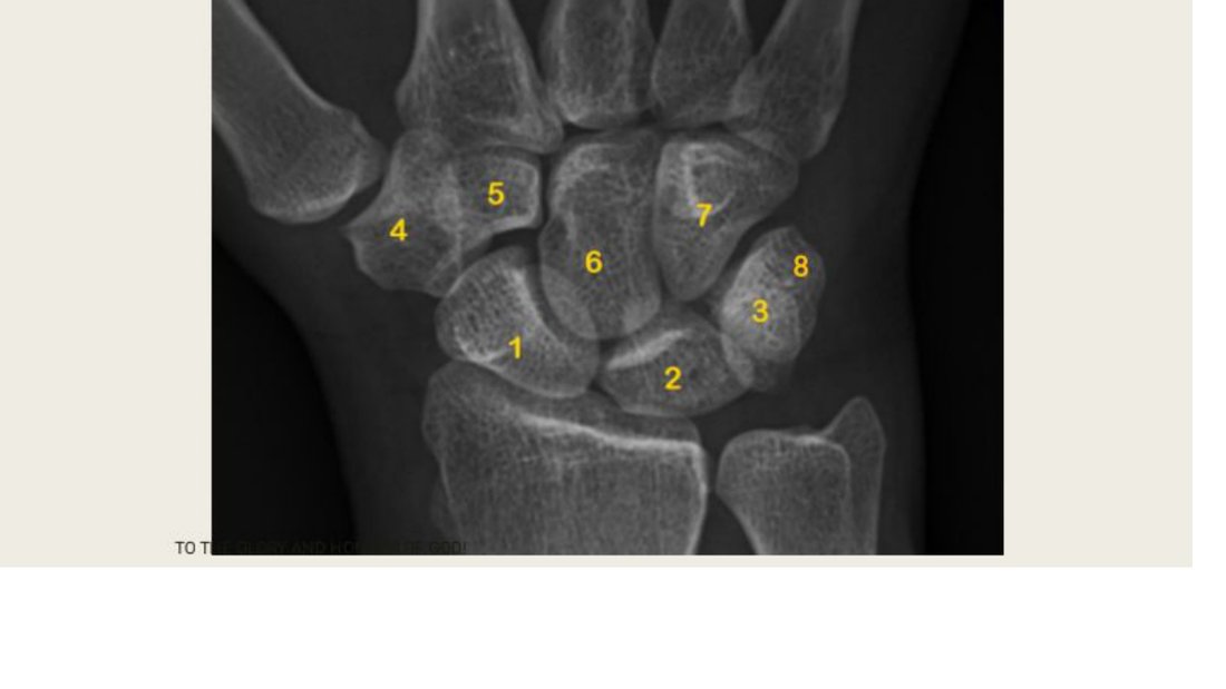 Q19 - wrist X-ray with carpal bones numbered