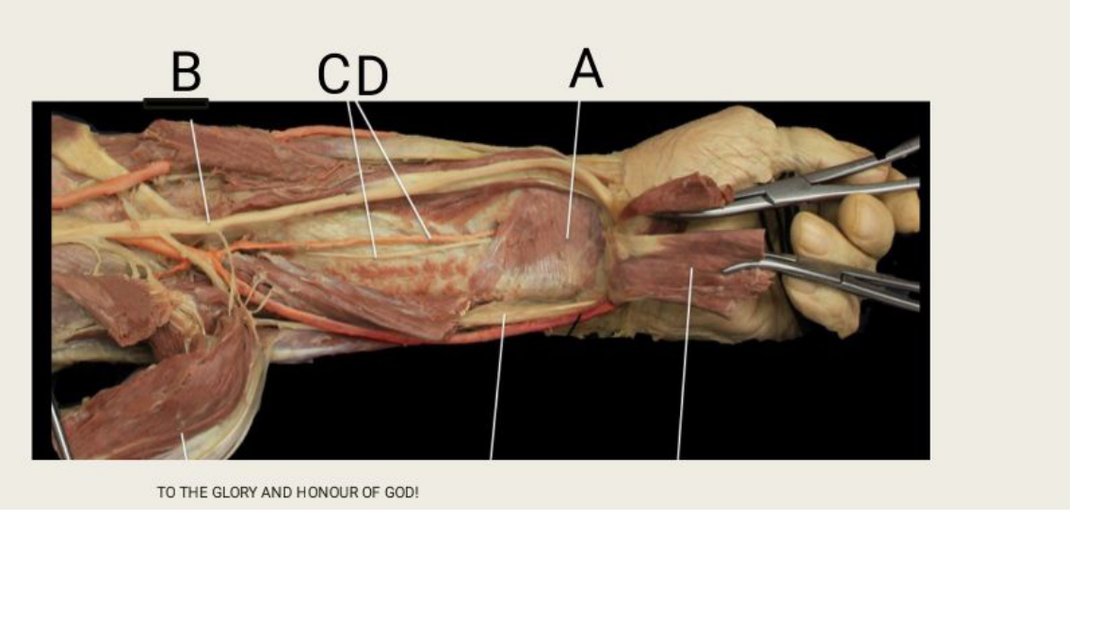 Q20 - forearm dissection with A, B, C, D labelled