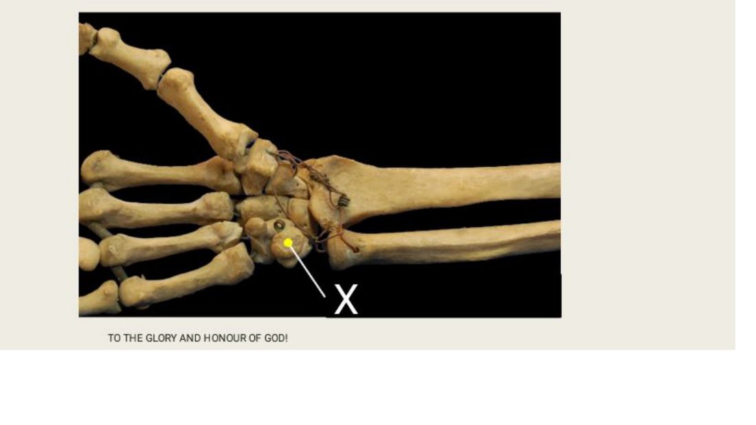 Q27 - wrist skeleton with a carpal bone tagged X
