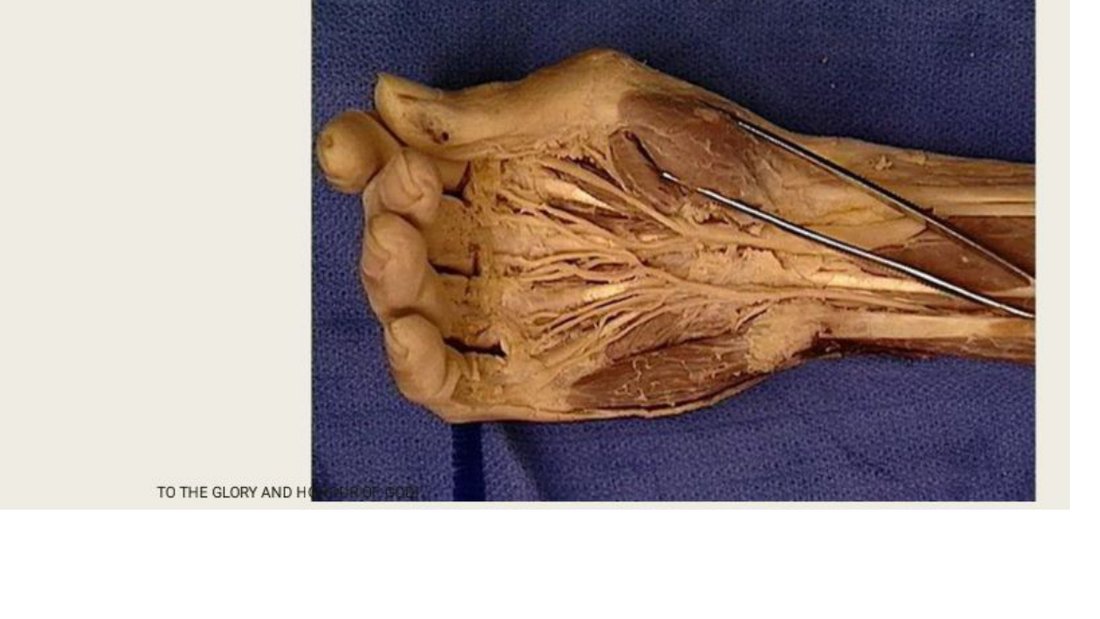 Q29 - thenar eminence dissection