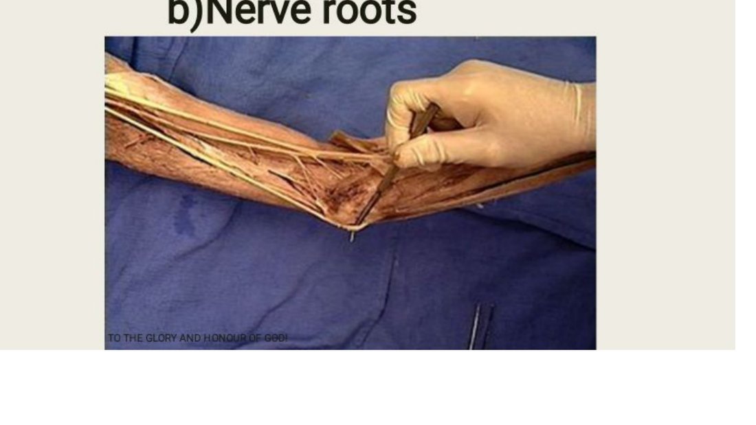 Q30 - nerve at the wrist crease