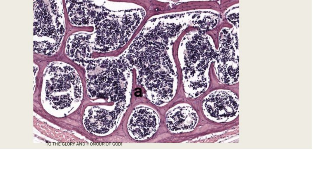 Q40 - testis histology with region a marked