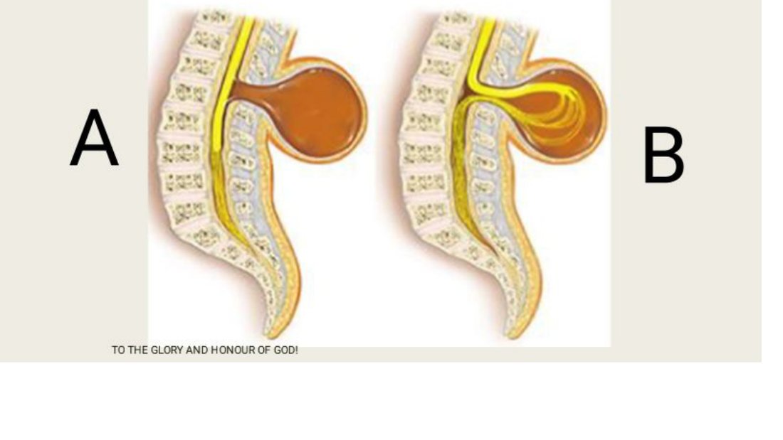 Q44 - diagram comparing two spina bifida variants