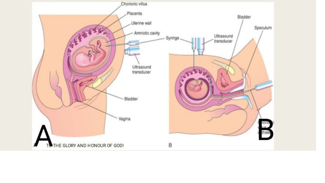 Q46 - diagrams of two prenatal sampling procedures