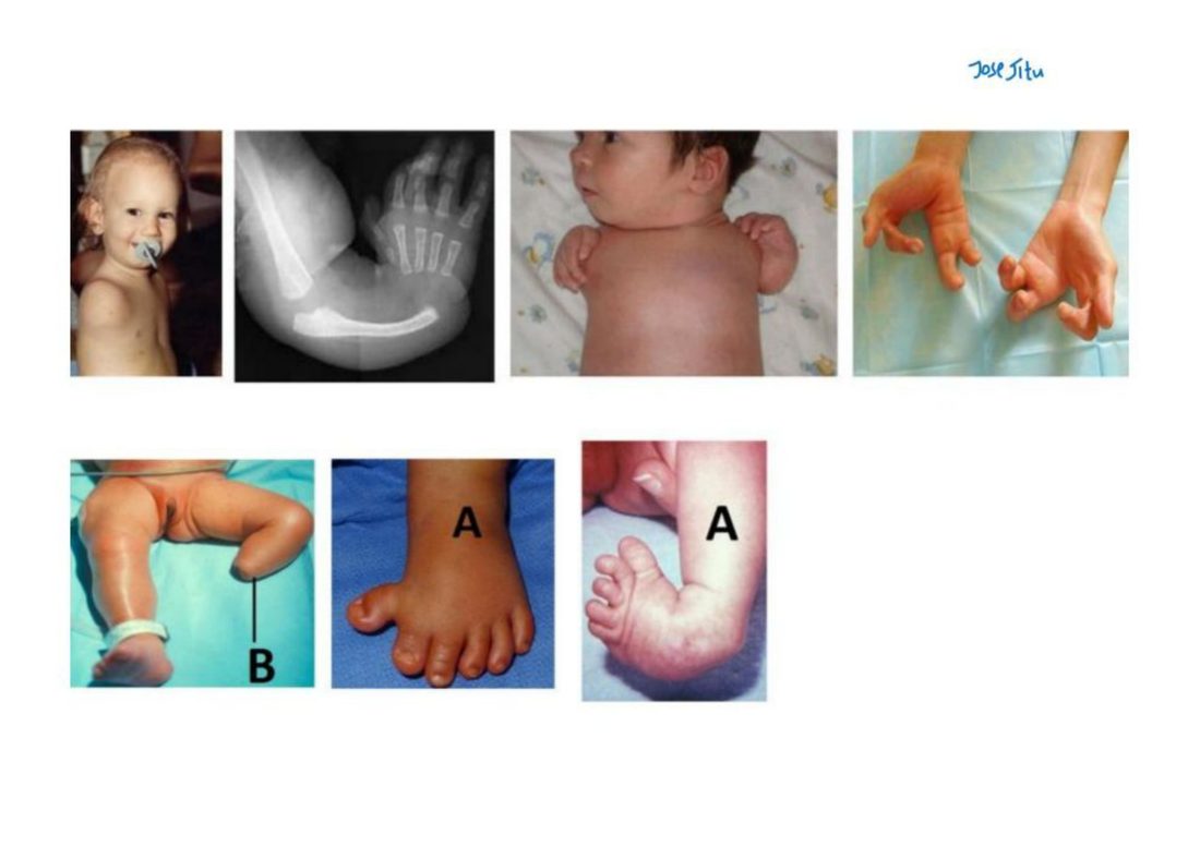 Number 26 continued - developing kidney, ureter and bladder diagram