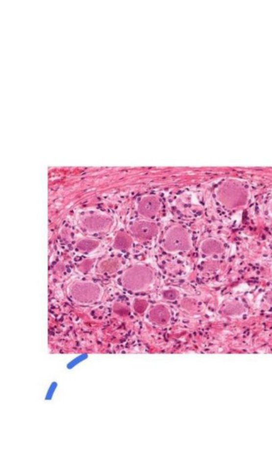 Photomicrograph of a sensory ganglion with clusters of large neuronal cell bodies