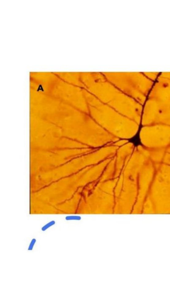 Golgi-stained photomicrograph of a pyramidal-shaped neuron with multiple dendrites, labelled A