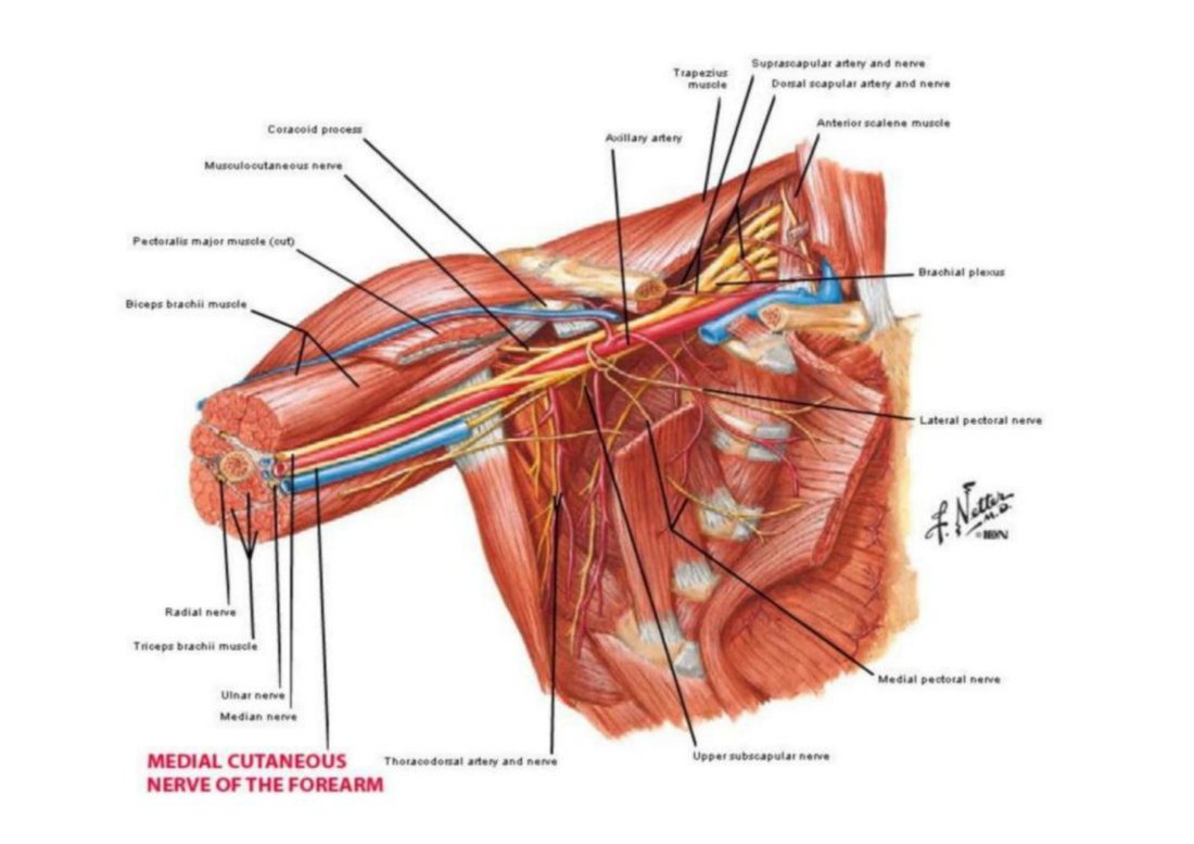 Netter illustration of the axilla with the axillary artery, brachial plexus cords and branches labelled