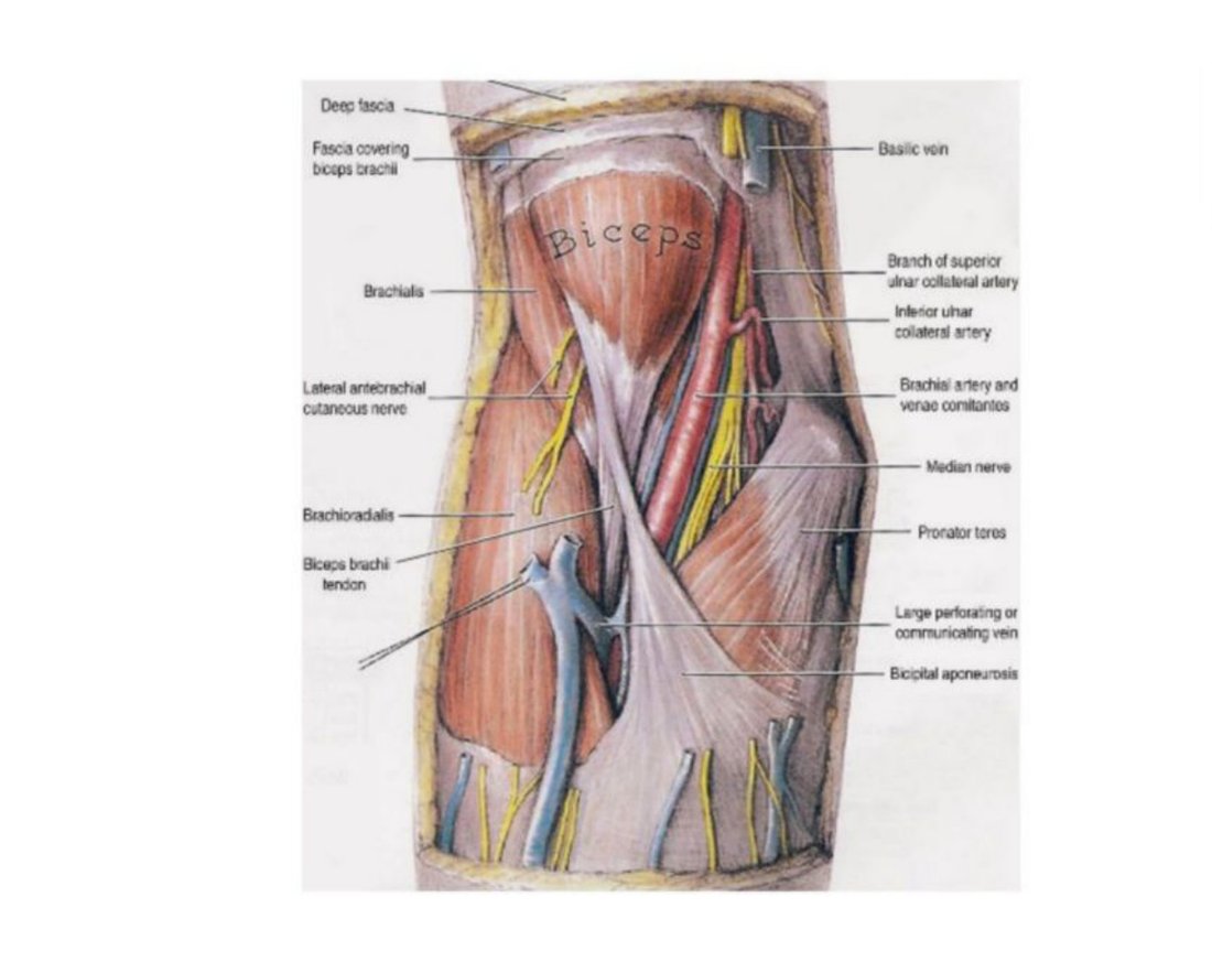 Dissection of the cubital fossa with the biceps tendon, brachial artery and median nerve labelled