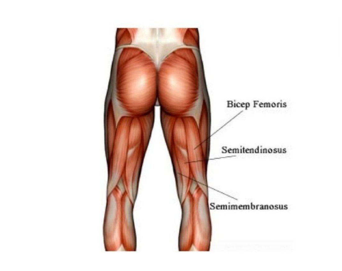Posterior thigh dissection with semitendinosus, semimembranosus and biceps femoris labelled