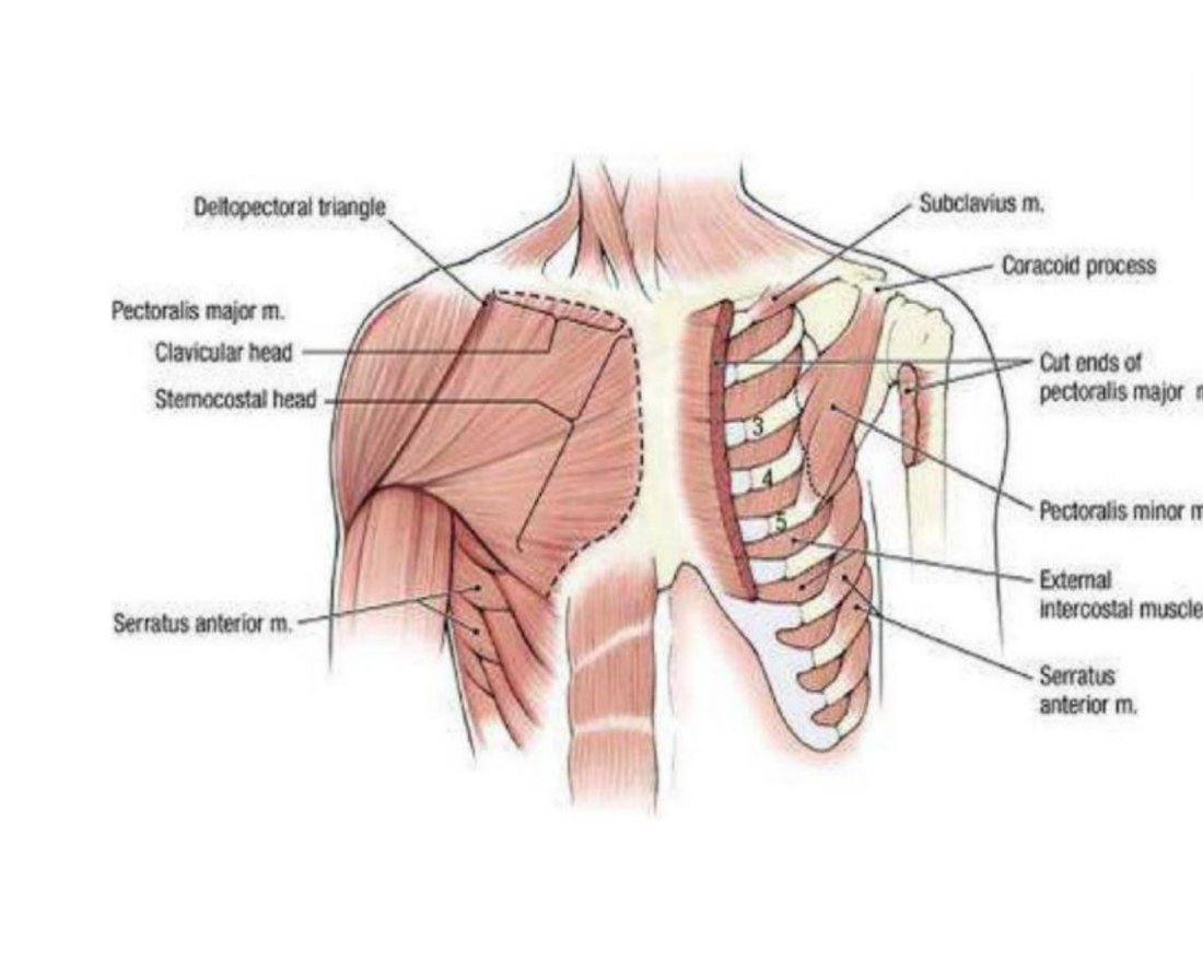 Anterior chest wall dissection with pectoralis major, pectoralis minor and serratus anterior labelled