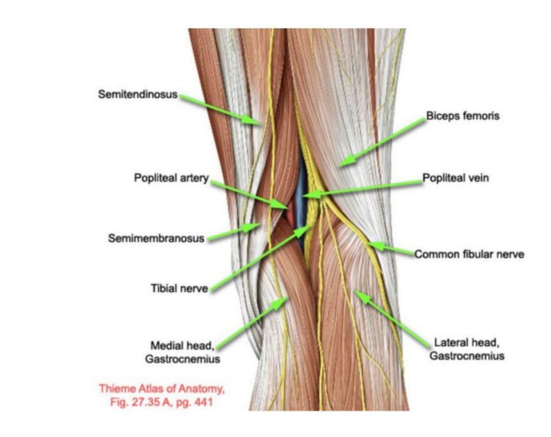 Popliteal fossa dissection with its boundaries, nerves and vessels labelled