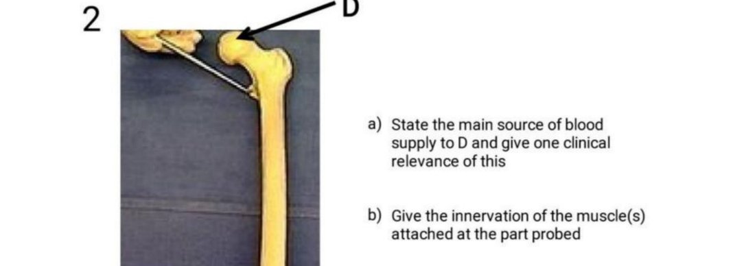 Q2 - femoral head with a landmark tagged D
