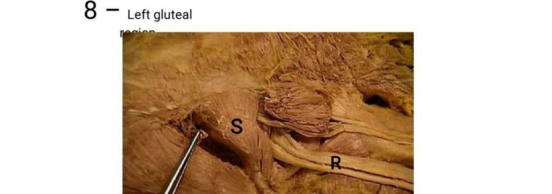 Q8 - gluteal region with R and S labelled